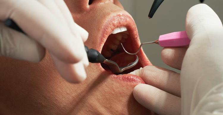 A close up of an open mouth with dental tools and the hands of a dentist