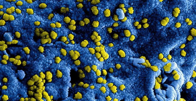 Group A strep virus