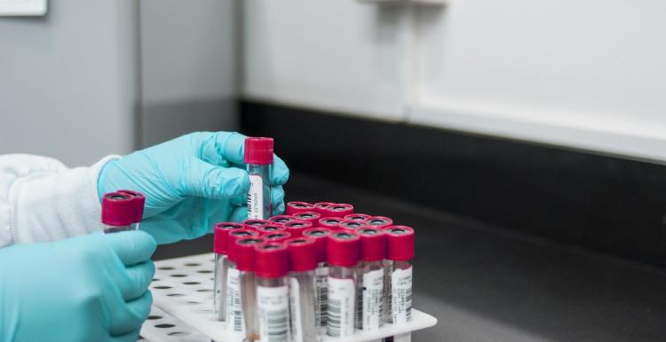 A rack of blood testing tubes A rack of blood testing tubes