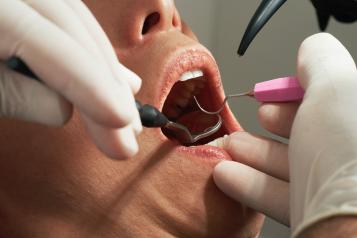 A close up of an open mouth with dental tools and the hands of a dentist