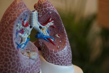 A model of a lung